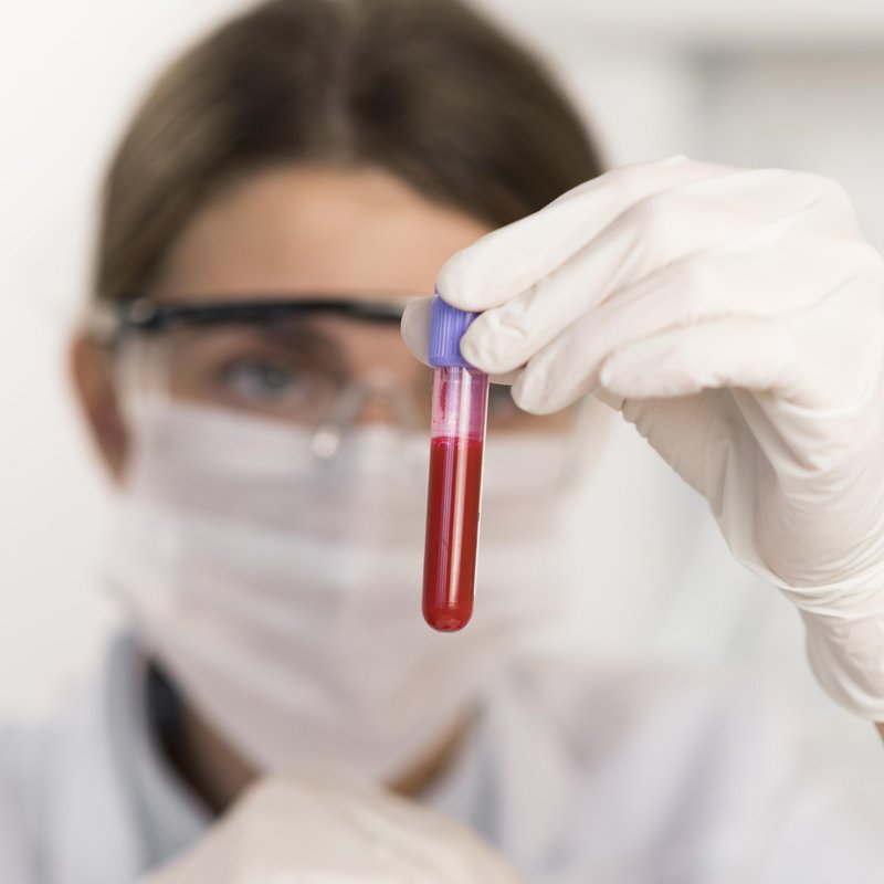 Blutprodukte Labor Blutprodukte Labor